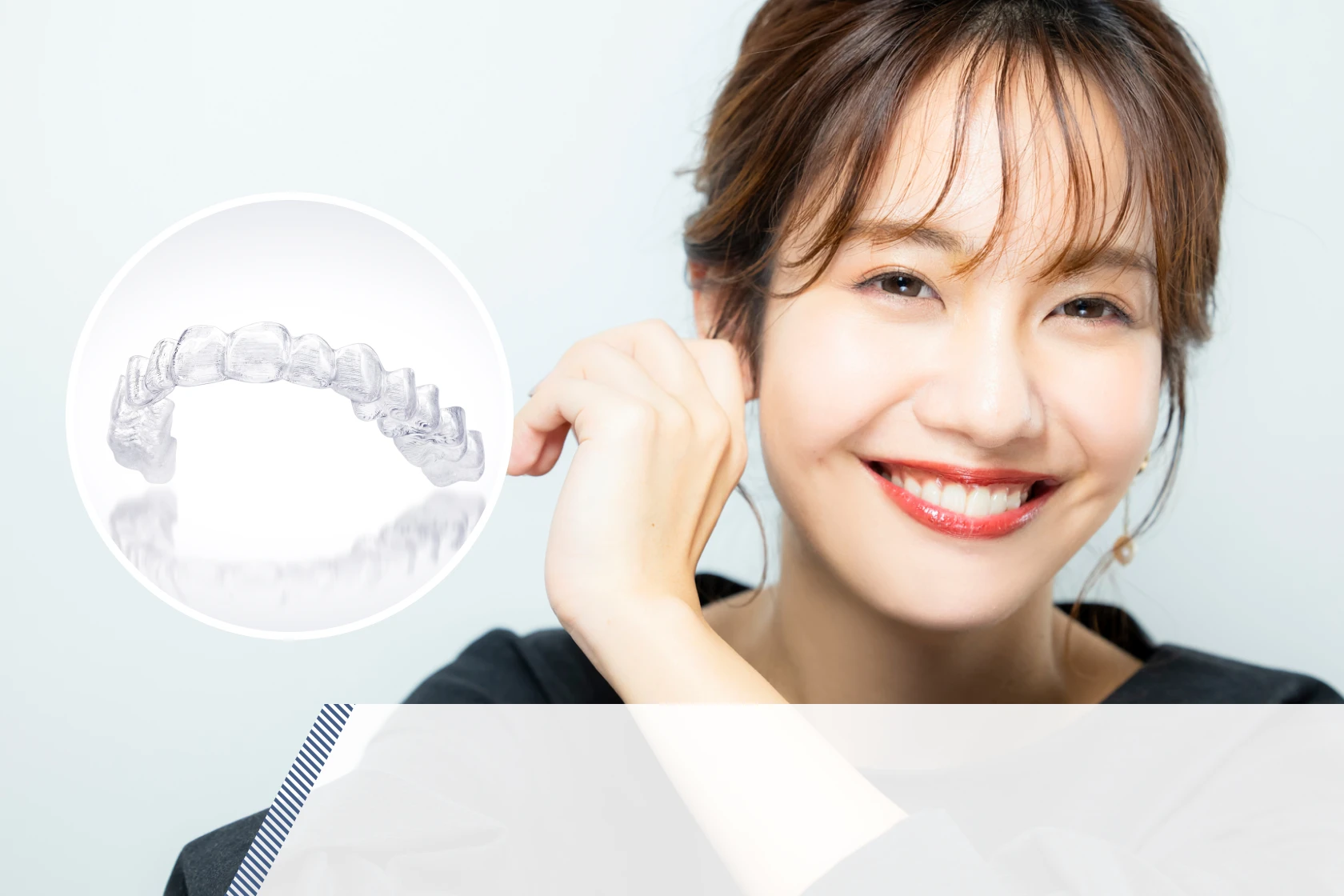 マウスピース矯正