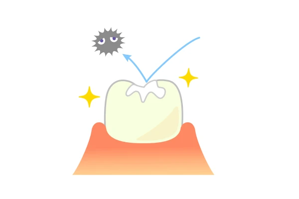 シーラントで奥歯の虫歯予防を