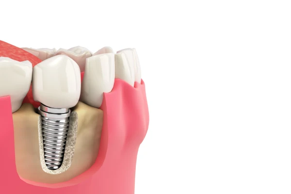 予防歯科を中心に