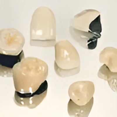 メタルボンドクラウン