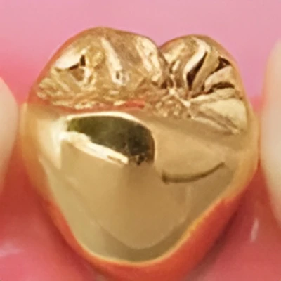 ゴールドクラウン